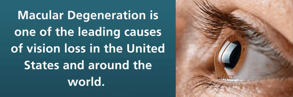 Right half of image is close up of human eye looking to the left. On the left, white text on dark blue background reads, "Macular Degeneration is one of the leading causes of vision loss in the United States and around the world."